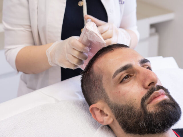 7 Tips Before Getting a Hair Transplant in Turkey