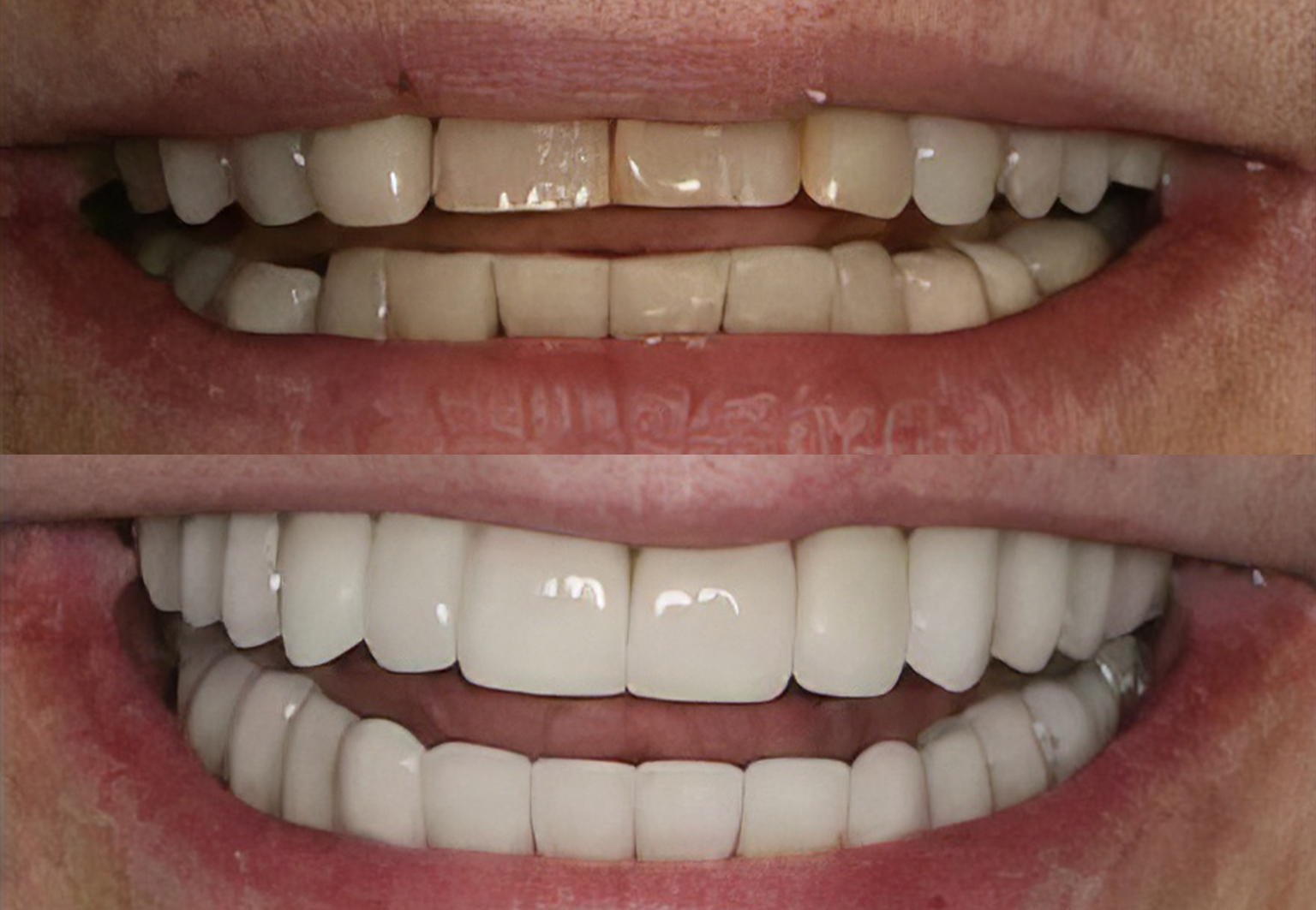 CareBridge - Cosmetic Dentistry - Before and after [01]