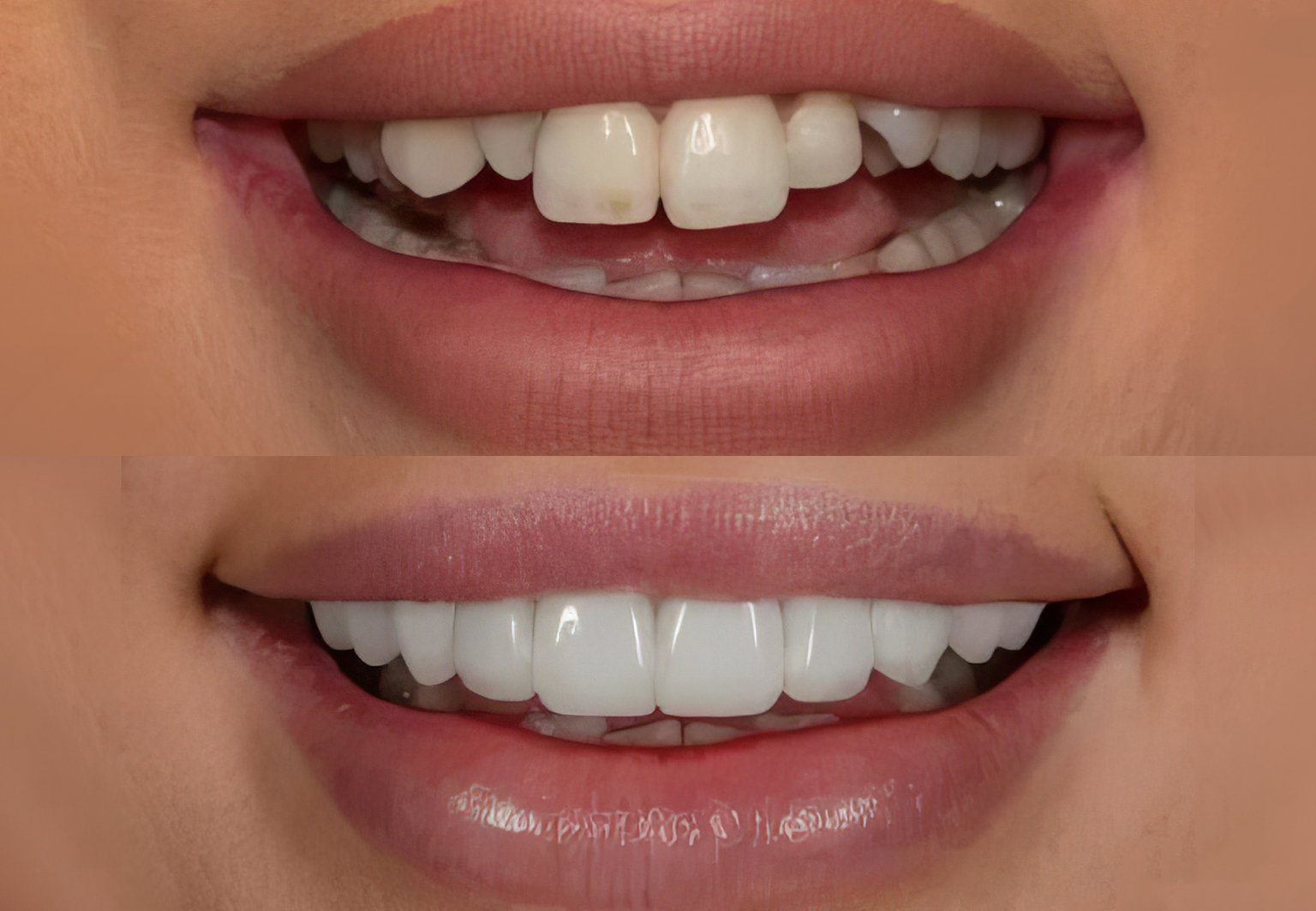 CareBridge - Cosmetic Dentistry - Before and after [06]
