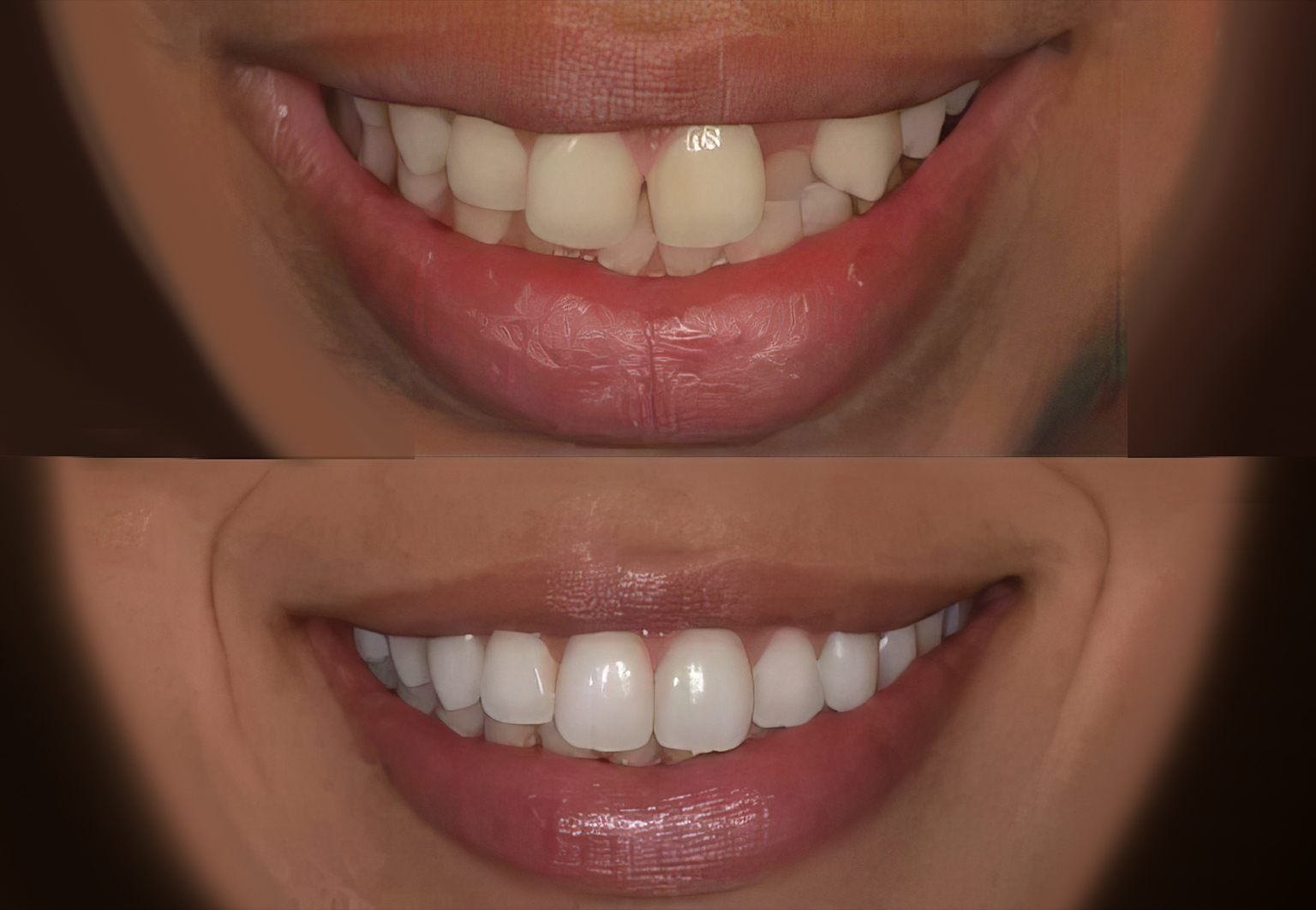 CareBridge - Cosmetic Dentistry - Before and after [07]
