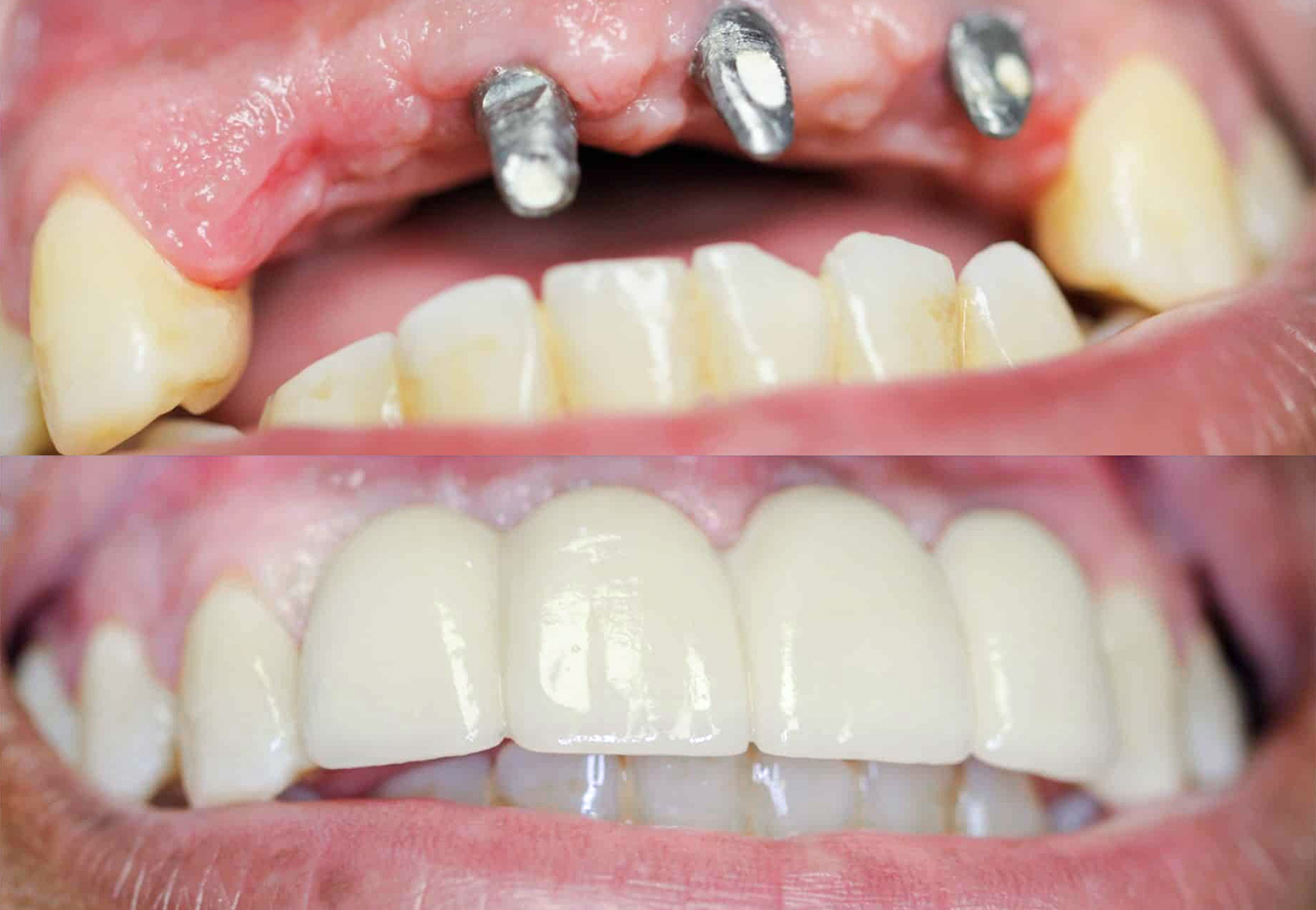 CareBridge - Cosmetic Dentistry - Before and after [08]
