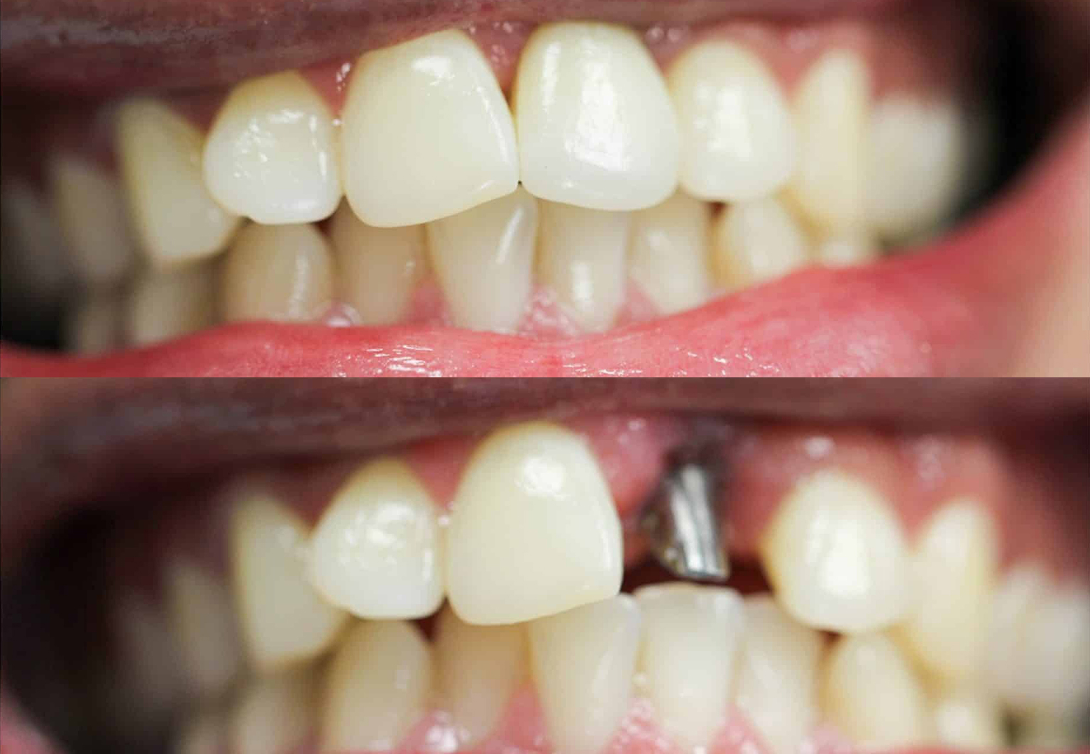 CareBridge - Cosmetic Dentistry - Before and after [09]