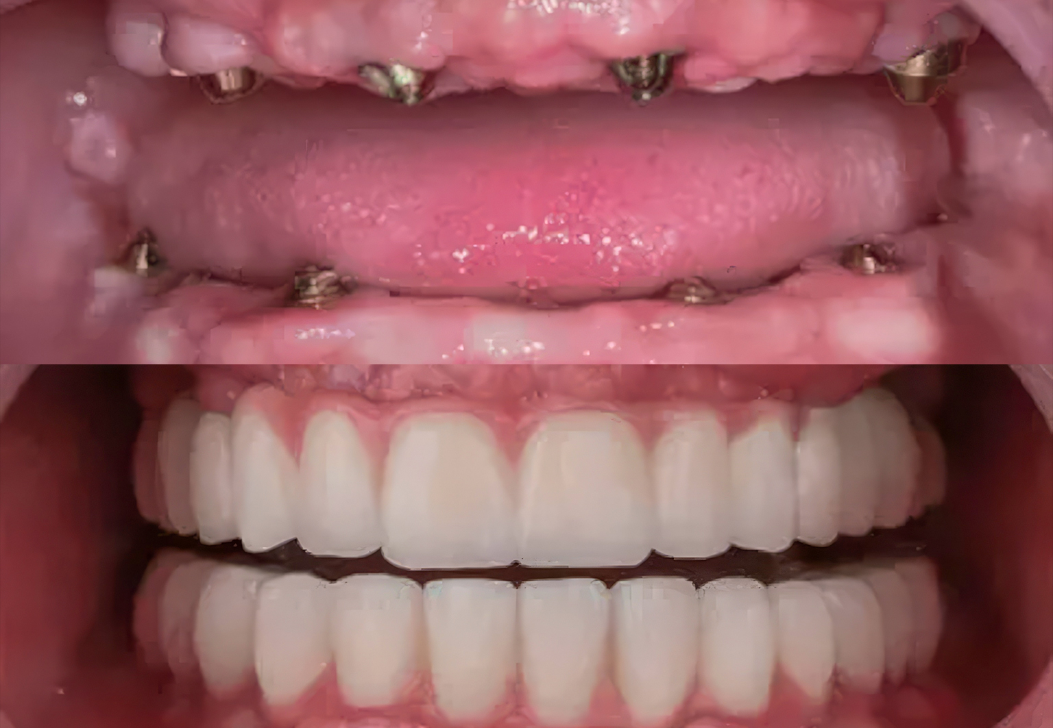 CareBridge - Cosmetic Dentistry - Before and after [10]