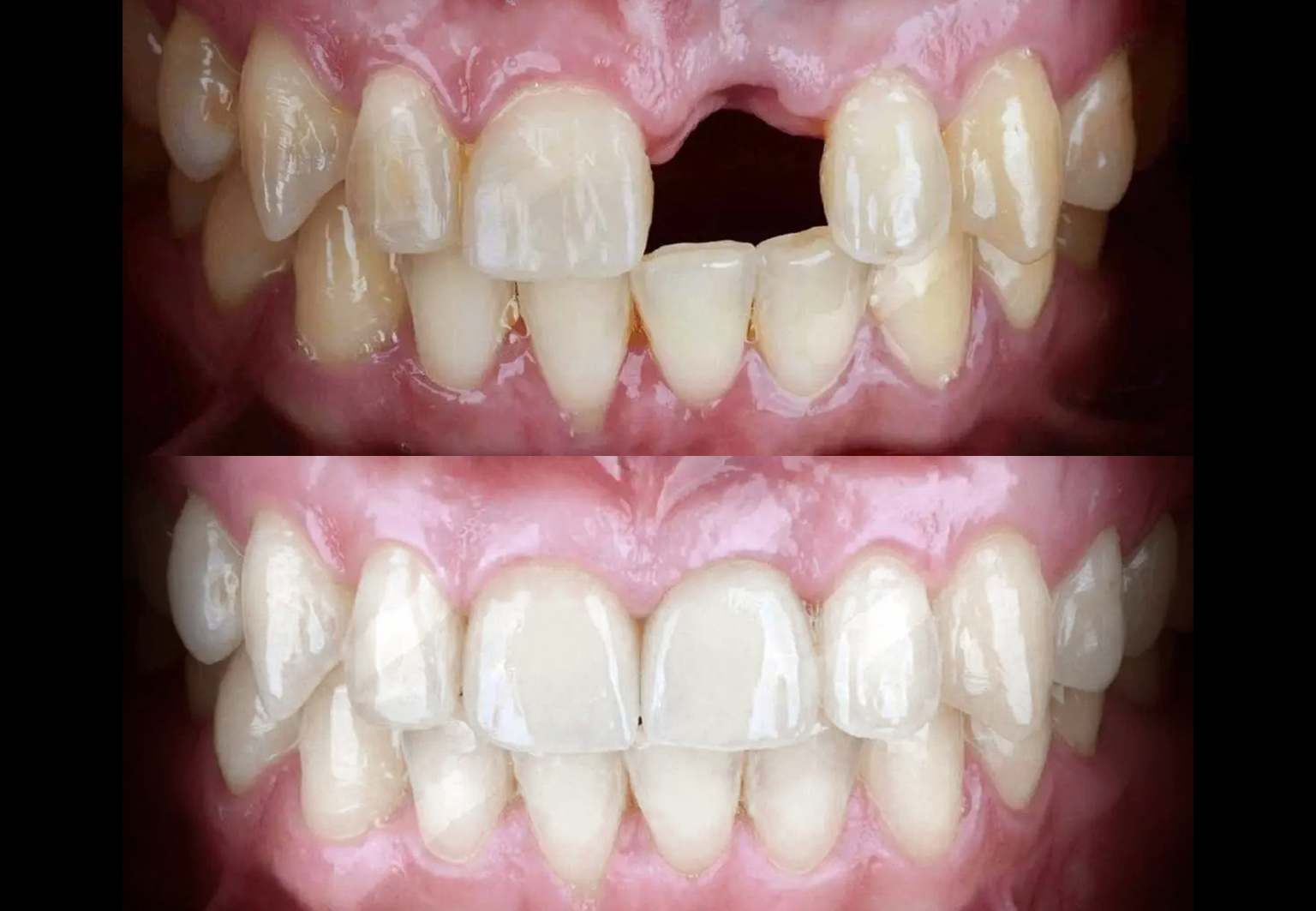 CareBridge - Cosmetic Dentistry - Before and after [11]