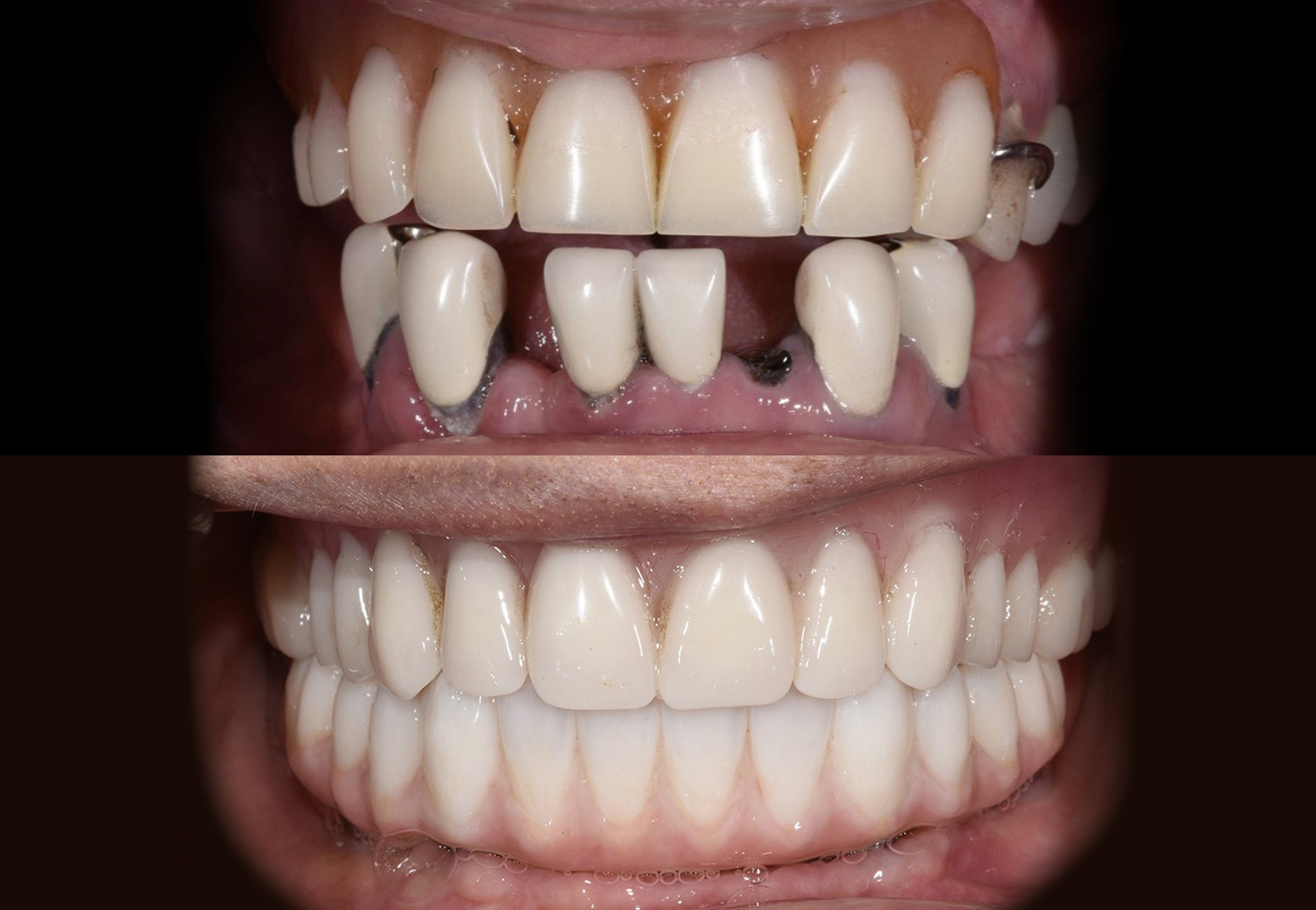 CareBridge - Cosmetic Dentistry - Before and after [13]