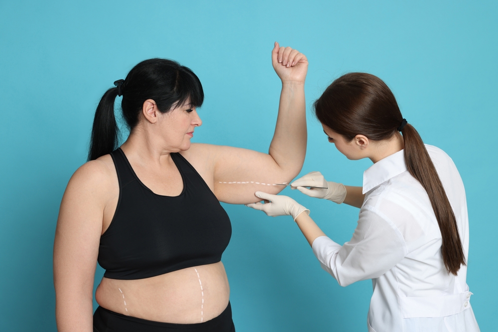 Arm lift in Turkey with Care Bridge US