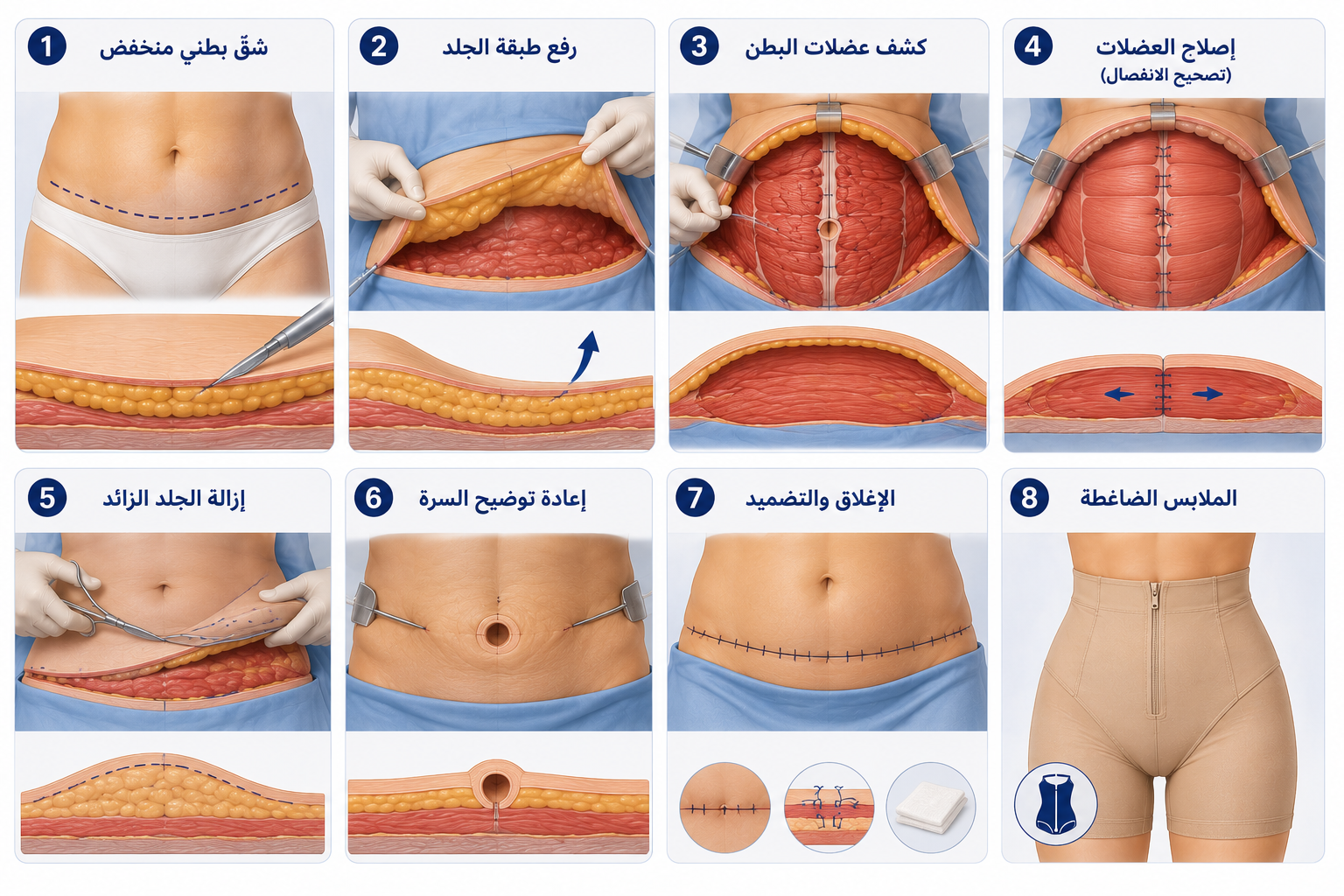 خطوات عملية شدّ البطن في تركيا - Care Bridge US خطوات عملية شدّ البطن في تركيا - Care Bridge US
