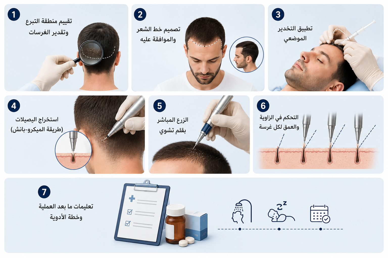 زراعة الشعرDHI t في تركيا مع Care Bridge US العملية