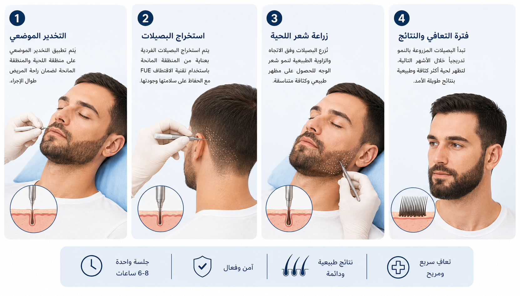 زراعة اللحية في تركيا Care Bridge US