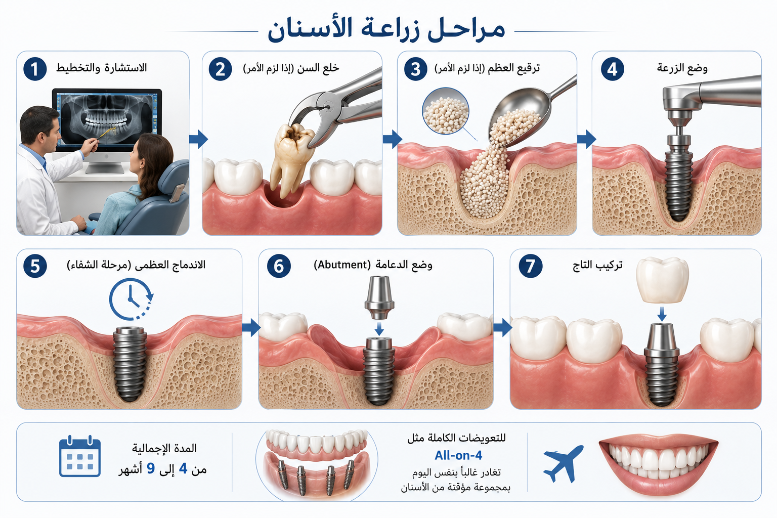 مراحل زراعة الأسنان في تركيا - Care Bridge US